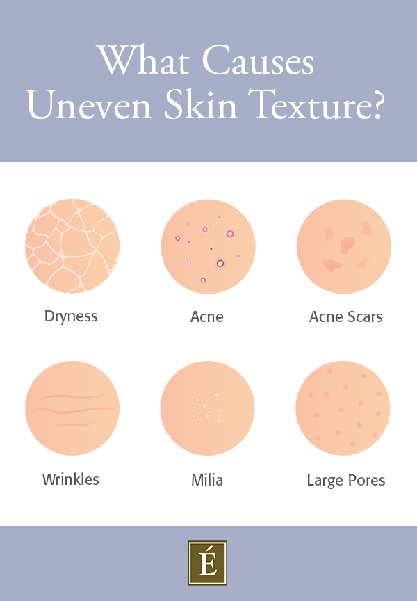 Causes of uneven skin texture